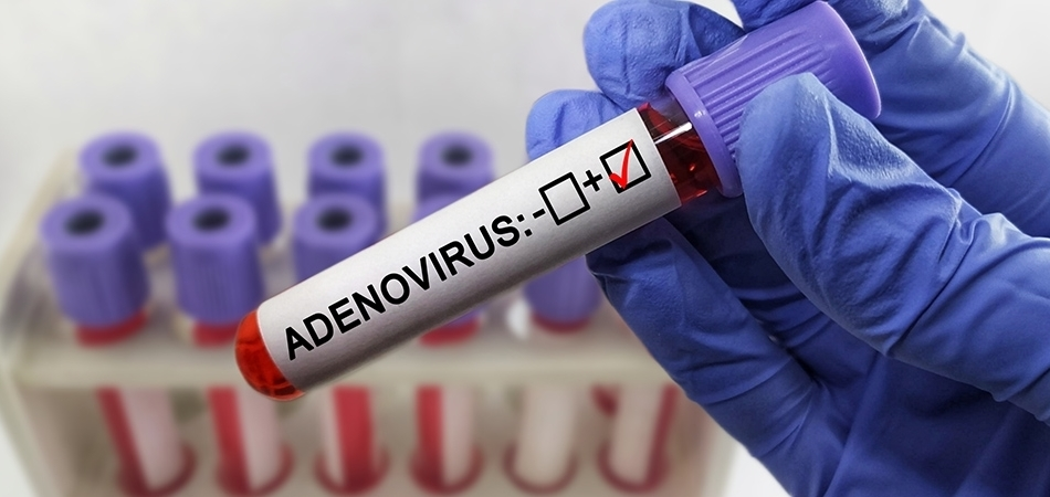 Adenovirüs nedir? Adenovirüs kaç günde geçer?