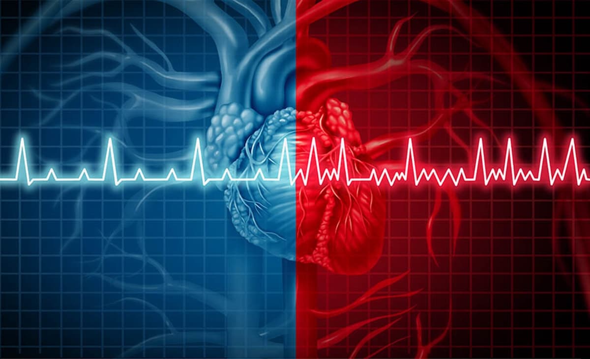 yüksek tansiyon riski 2 nco yüksek tansiyon durumunda kalp atış hızı
