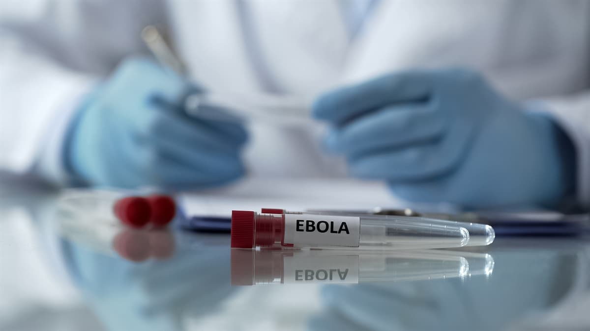 Ebola Virüsü Nedir ve Belirtileri Nelerdir? Nasıl Tedavi Edilir?