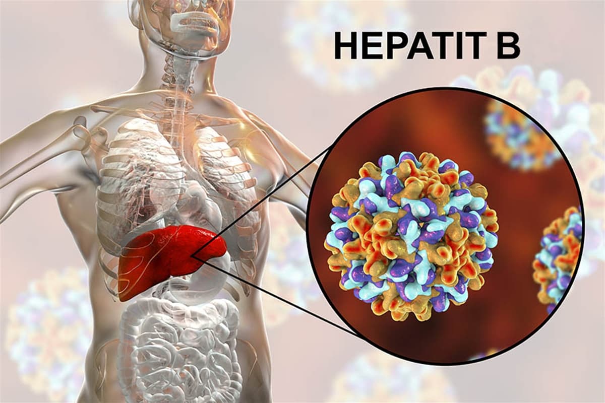 Hepatit B Nedir ve Belirtileri Nelerdir?