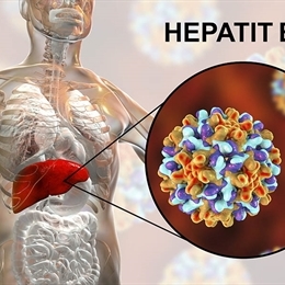 Hepatit B Nedir ve Belirtileri Nelerdir?