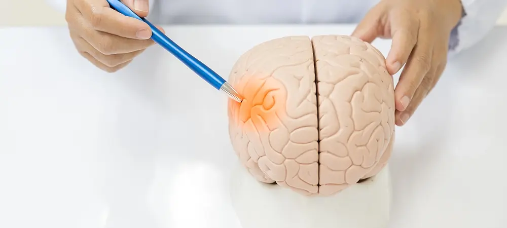 Hidrosefali nedir? Hidrosefali neden olur?