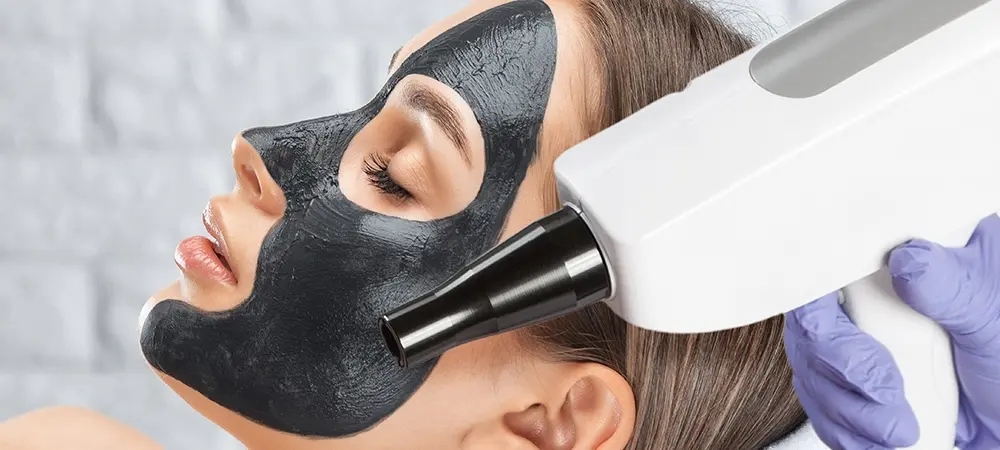 Karbon peeling ne işe yarıyor? Karbon peelingin faydaları neler? Karbon peeling ne işe yarıyor? Karbon peelingin faydaları neler?