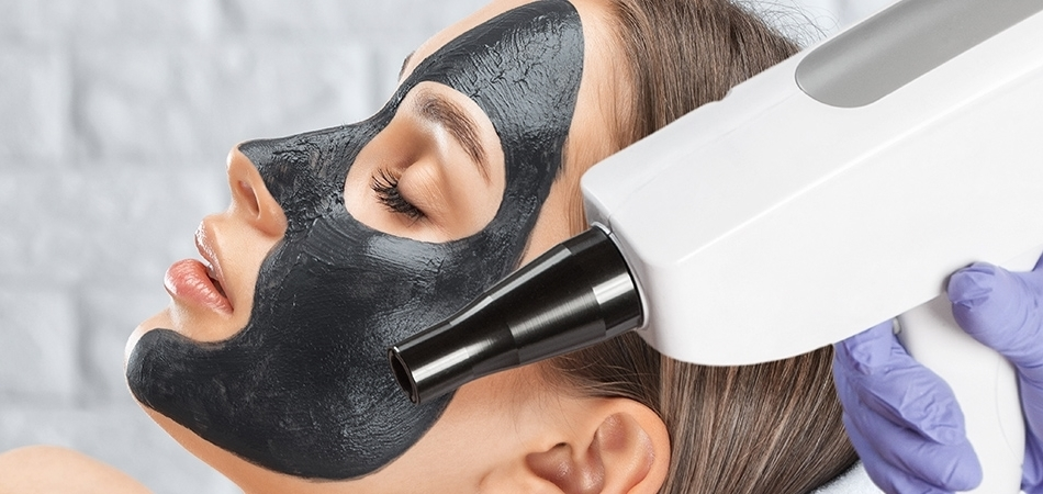 Karbon peeling ne işe yarıyor? Karbon peelingin faydaları neler?