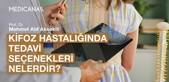Kifoz Hastalığında Tedavi Seçenekleri Nelerdir?