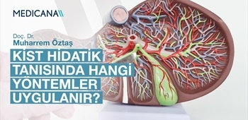 Kist Hidatik Tanısında Hangi Yöntemler Uygulanır?