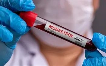 Maymun çiçeği virüsü (monkeypox) nedir? Maymun çiçeğinin belirtileri nelerdir?