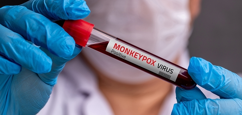 Maymun çiçeği virüsü (monkeypox) nedir? Maymun çiçeğinin belirtileri nelerdir?