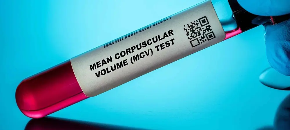 MCV ne anlama gelir? MCV düşüklüğü için hangi vitamin kullanılır? MCV ne anlama gelir? MCV düşüklüğü için hangi vitamin kullanılır?