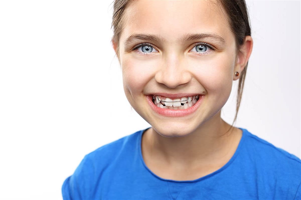 Ortodonti Tedavisinde Uyarılar
