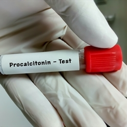 Prokalsitonin (PCT)