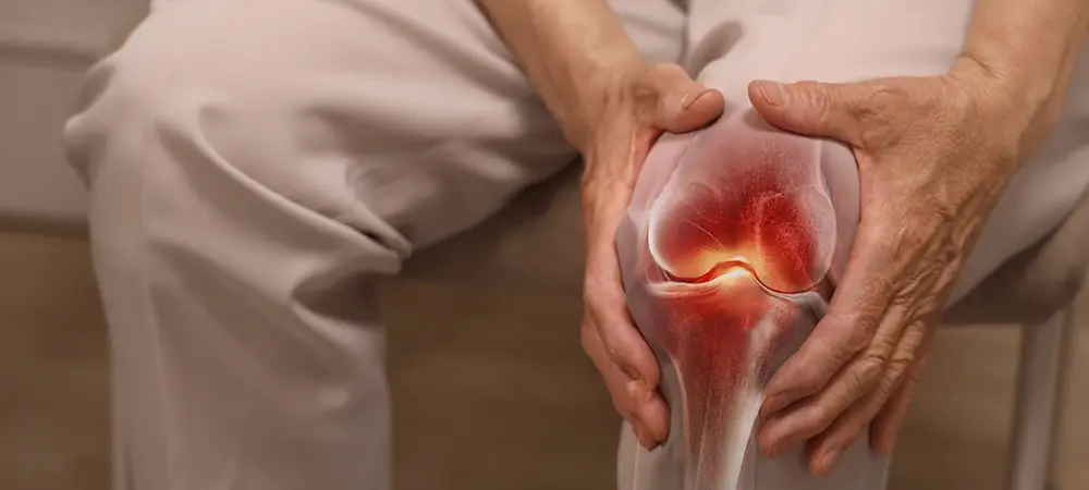 Romatoid artrit nedir? Romatoid artritin belirtileri neler? Romatoid artrit nedir? Romatoid artritin belirtileri neler?