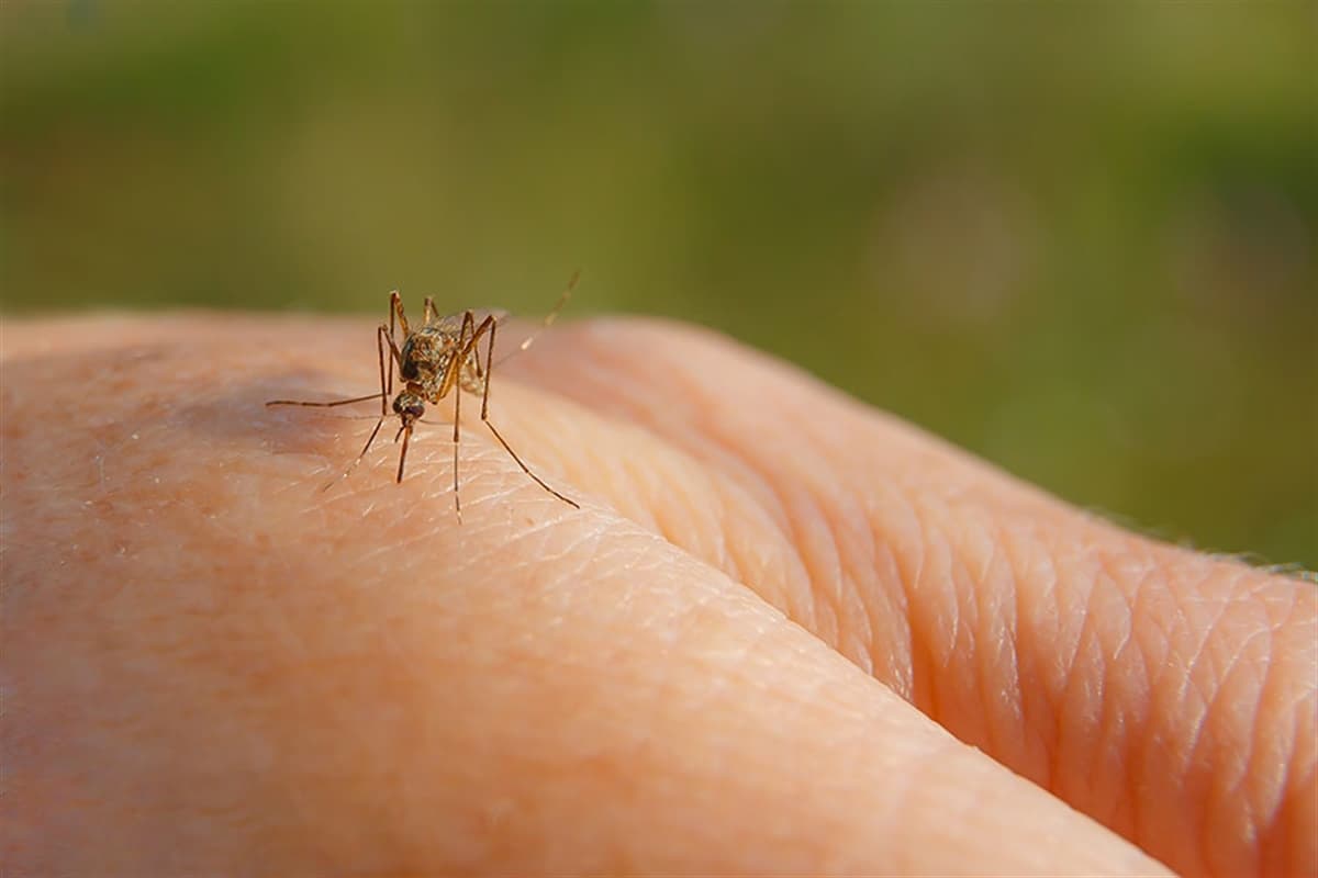 Sivrisinek Isırığına (Kaşıntısına) Ne İyi Gelir & Nasıl Geçer?