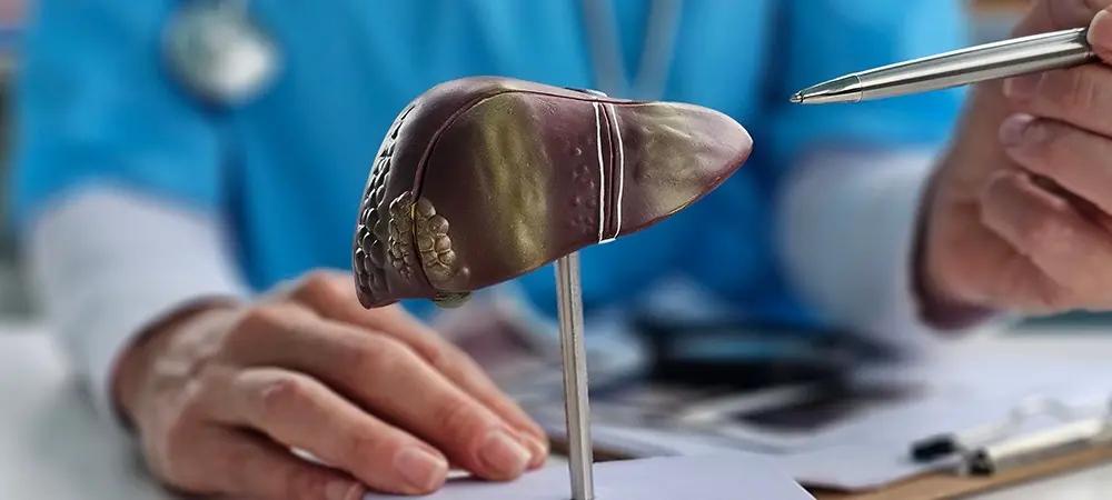 Siroz neden olur? Siroz hastalığı iyileşir mi? Siroz neden olur? Siroz hastalığı iyileşir mi?