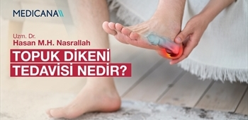 Topuk Dikeni Tedavisi Nedir?