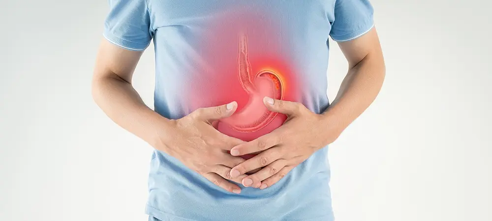 Ülser nedir? Ülser belirtileri neler? Ülser nedir? Ülser belirtileri neler?