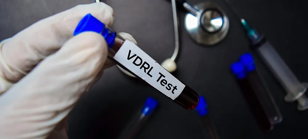 VDRL testi nedir? VDRL testi neden yapılır? VDRL testi nedir? VDRL testi neden yapılır?