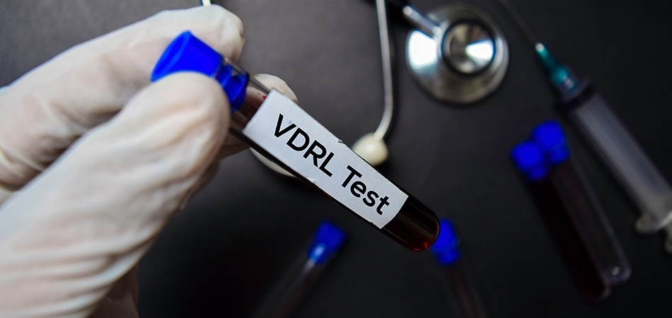 VDRL testi nedir? VDRL testi neden yapılır?