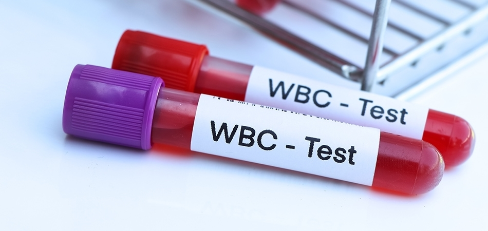 WBC nedir? WBC yüksekliği ne anlama gelir?