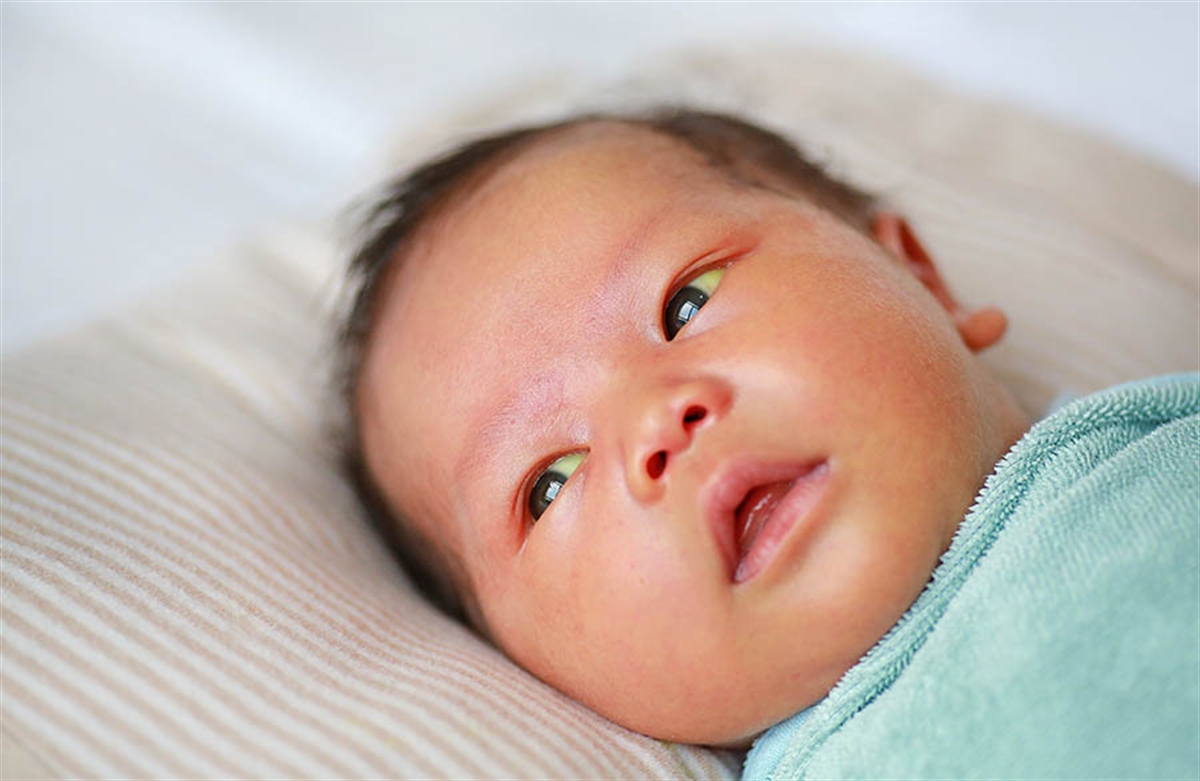 bebeklerde sarilik degeri kac olursa tehlikeli bebek battaniyesi